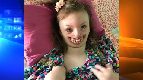 North Carolina Mom Of Girl With Facial Deformity Fights Twitter User Who Used Daughters Photo