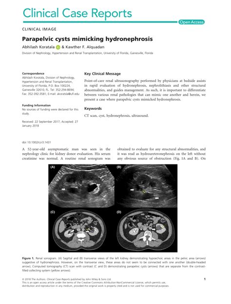 Pdf Parapelvic Cysts Mimicking Hydronephrosis
