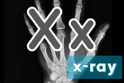 Xxx X Ray Telegraph
