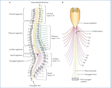 Differences Between Conus Medullaris And Cauda Equina