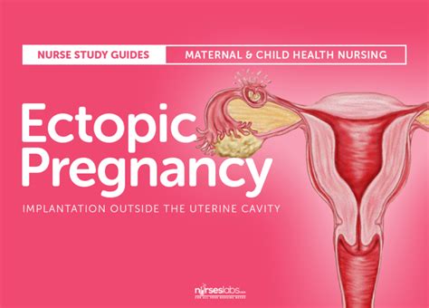 Ectopic Pregnancy Nursing Care Plan