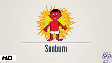 Sunburn Causes Signs And Symptoms Diagnosis And Treatment Youtube