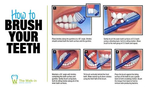 How To Brush Your Teeth The Walk In Dental Centre Dentist