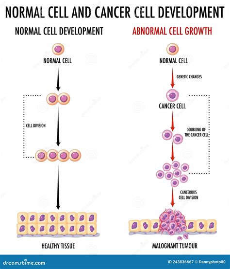 Diagram Showing Normal Cell And Cancer Cell Stock Vector Illustration