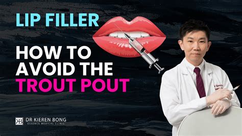 Lip Fillers How To Avoid The Trout Pout Advice From A Cosmetic