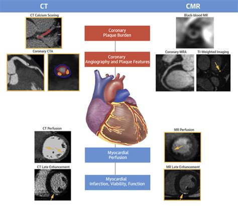 Computed Tomography And Cardiac Magnetic Resonance In Ischemic Heart