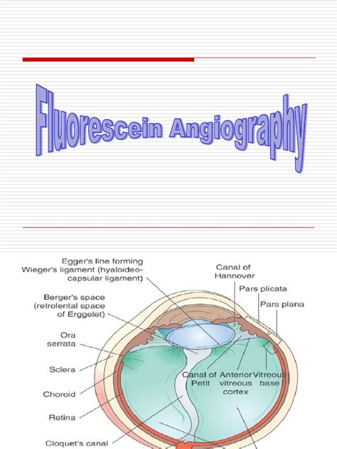 Fluorescein Angiography Retina Eye