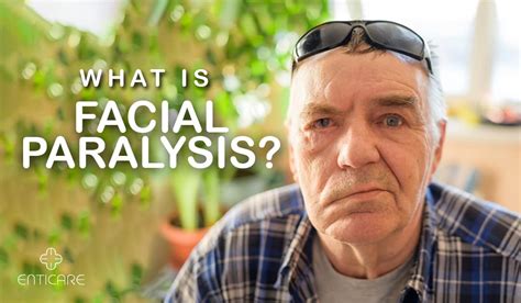 What Is Facial Paralysis Enticare Ear Nose And Throat Doctors