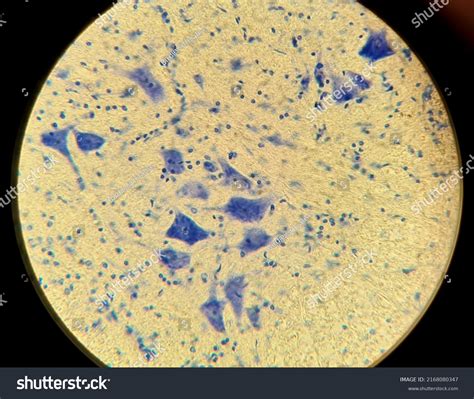 Nervous Tissue Under Microscope Neurocytes Processes Foto Stock