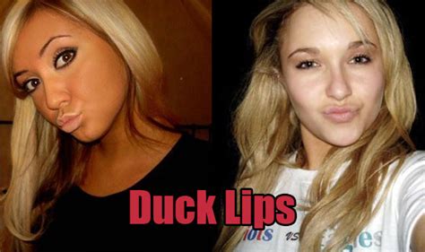Death To The Dreaded Duck Lips Pose