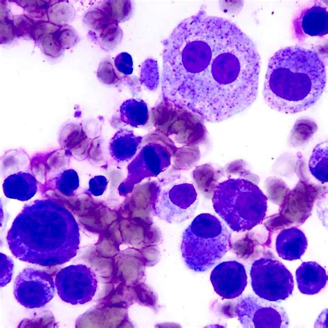 Mast Cell Tumor Cat Cytology Cat Meme Stock Pictures And Photos