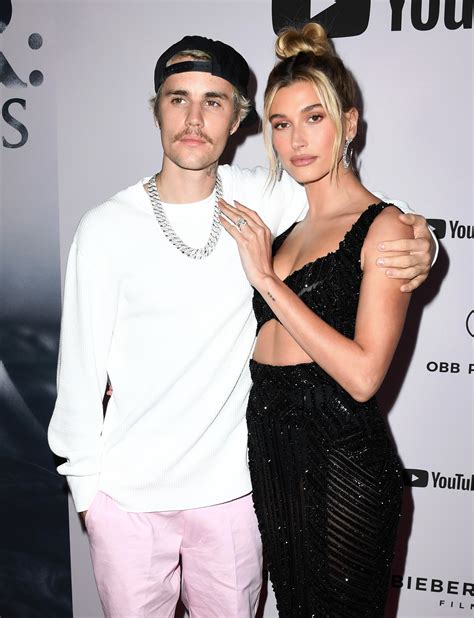 hailey bieber sobre síndrome rara de justin bieber situação assustadora quem quem news