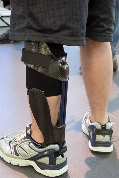 Orthotic Brace Takes Soldiers From Limping To Leaping Wbur News