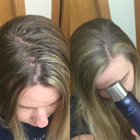Before And After MONAT Monat Hair Hairstyles For Thin Hair Hair Care