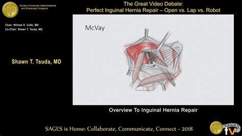 Open Inguinal Hernia Repair Anatomy Anatomy Structure