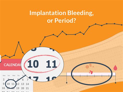 Most Accurate Implantation Bleeding Or Period Quiz
