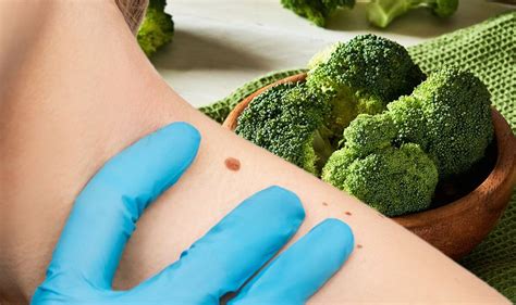 Cancer Broccoli May Reduce The Size And Number Of Cancer Cells By Up