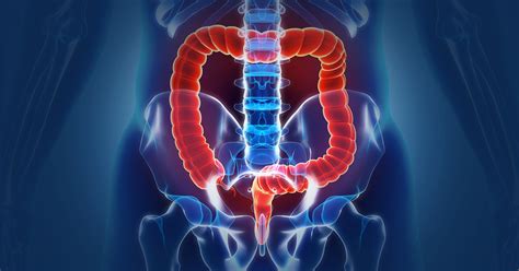colon and rectal surgery medstar health