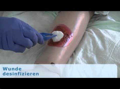 Desinfektion von innen nach aussen sept. Hygienische Aspekte beim Wechseln eines Wundverbandes ...