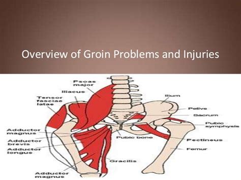 Groin Injuries And Problems