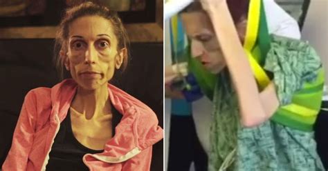 Rachael Farrokh Severely Anorexic Actress Takes First Steps One Month