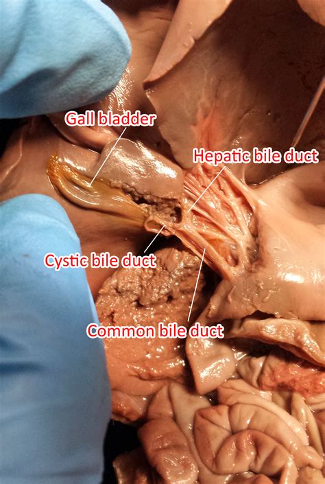 Photos Of The Pig Digestive System