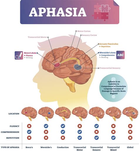 What Is Aphasia And Can Rehab Slow Its Effects Utsw Medblog