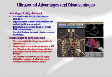 Ppt Medical Physics Ultrasound Powerpoint Presentation Id5588587