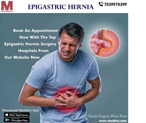 Hernia Types Symptoms Causes Diagnosis Treatment Vrogue Co