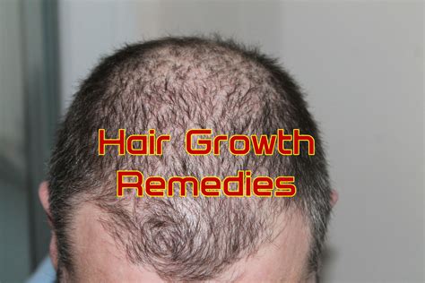 10 Home Remedies For Hair Growth Home Remedies App