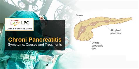 Chronic Pancreatitis Symptoms Causes And Treatment Optionslpc