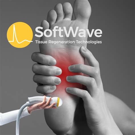 Curious About Plantar Fasciitis Treatment Does Softwave Therapy Work