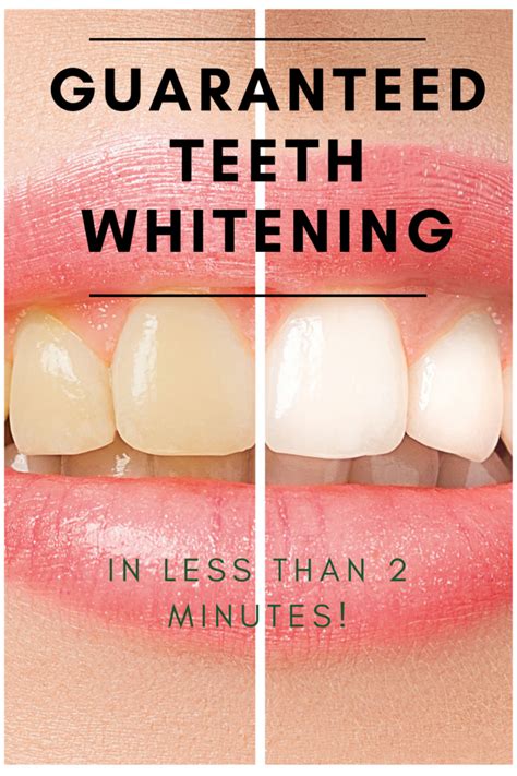 Guaranteed Teeth Whitening In Less Than 2 Minutes Weight Loss