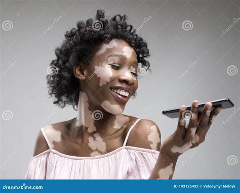 Studio Portrait Of African American Woman With Vitiligo Skin Beauty