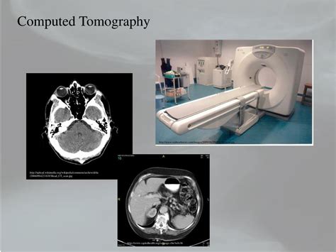 Ppt Computed Tomography Powerpoint Presentation Free Download Id