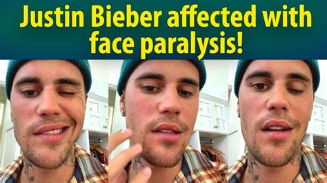 Singer Justin Bieber Reveals About His Condition After Diagnosing With