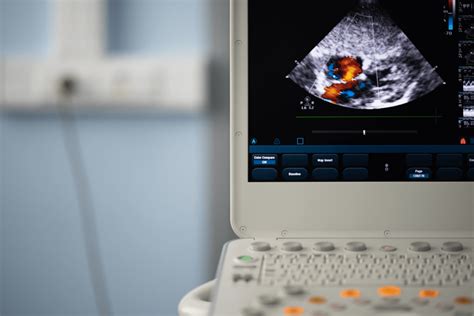 Echocardiogram In El Paso Tx Advanced Ultrasound Care