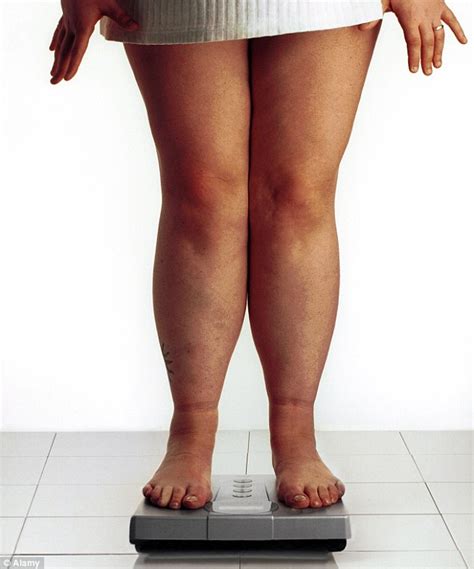 Knee Replacements For Obese People Soar By 150 In Four Years