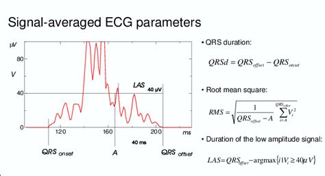 Parameters From The Signal Averaged Highresolution Ecg Duration Of The