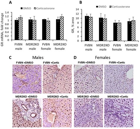 Glucocorticoid Receptor Gr Expression In The Liver Of Male And Female Download Scientific