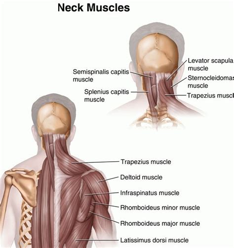 Back Muscle Spasms