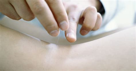 Acupuncture For Acid Reflux Livestrongcom