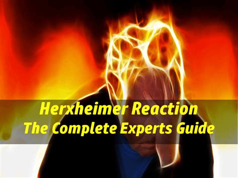 Although the experience may not make you feel particularly good, the. Herxheimer Reaction: What is the jarisch herxheimer reaction?