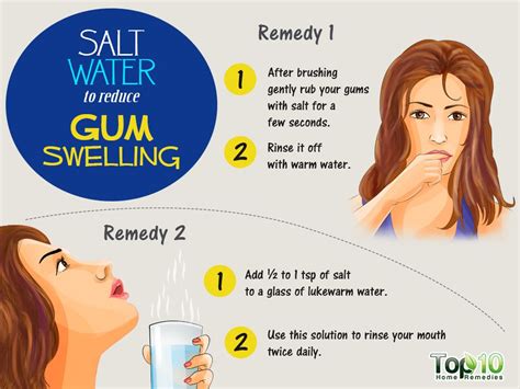 Home Remedies To Reduce Gum Swelling Top 10 Home Remedies Swollen