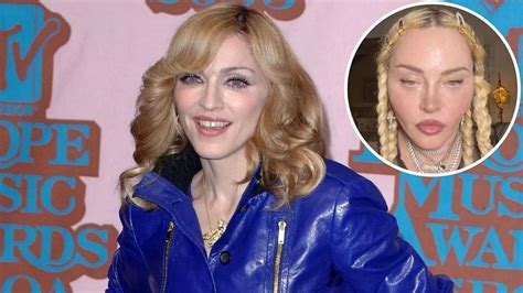 What Happened To Madonnas Face A Look Into Her Plastic Surgery As Actor Looks Unrecognizable