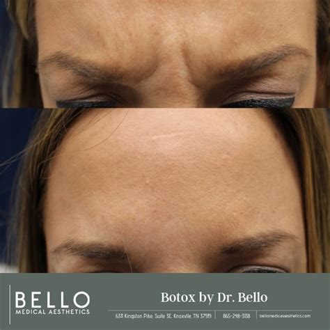 About Us Bello Medical Aesthetics