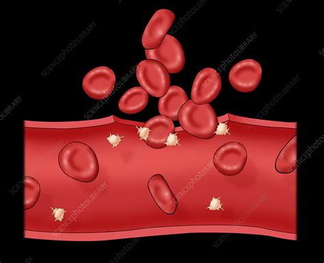 Blood Clot Stock Image C0306740 Science Photo Library
