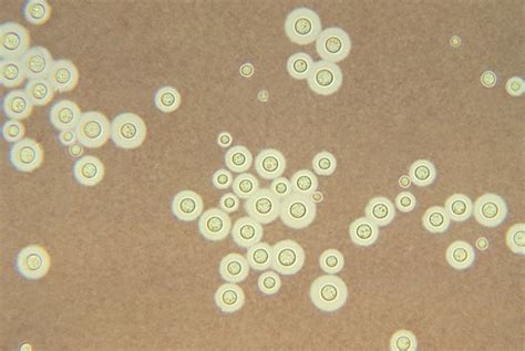 Cryptococcus Neoformans Wikidoc