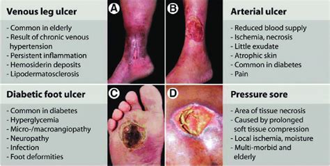 Clinical Presentations Of Various Chronic Wound Pathologies Impaired Download Scientific
