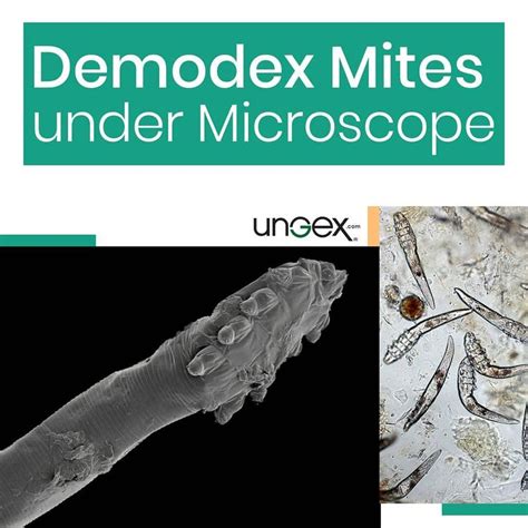 Demodex Mites Under The Microscope Ungex Demodex Treatment In 2021